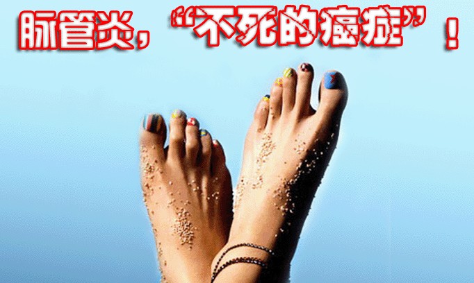 脉管炎早期症状检查