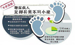糖尿病足病人的注意事项有哪些?