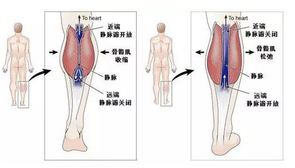 静脉曲张与患者的年龄等有关系吗