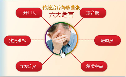 小腿静脉曲张怎么治疗效果好？
