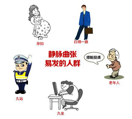 怎样预防静脉曲张都有哪些方法？